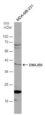 Western Blot: DNAJB6 Antibody [NBP1-32175] - Whole cell extract (30 ug) was separated by 12% SDS-PAGE, and the membrane was blotted with DNAJB6 antibody (NBP1-32175) diluted at 1:500.