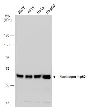 Western Blot: NUP62 Antibody [NBP1-32177] - Various whole cell extracts (30 ug) were separated by 7.5% SDS-PAGE, and the membrane was blotted with NUP62 antibody (NBP1-32177) diluted at 1:1000. The HRP-conjugated anti-rabbit IgG antibody  was used to detect the primary antibody.