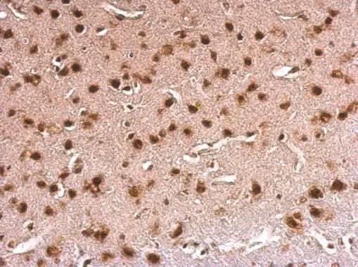 Immunohistochemistry: ERH Antibody [NBP1-32198] - ERH antibody detects ERH protein at nucleus on mouse fore brain by immunohistochemical analysis. Sample: Paraffin-embedded mouse fore brain. ERH antibody (NBP1-32198) dilution: 1:500.Antigen Retrieval: Trilogy™ (EDTA based, pH 8.0) buffer, 15min