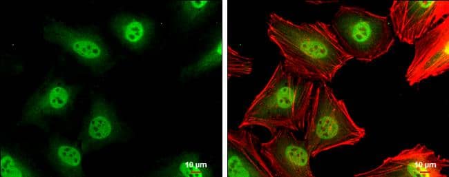 p27/Kip1 antibody detects p27/Kip1 protein at cytoplasm and nucleus by immunofluorescent analysis.Sample: HeLa cells were fixed in 4% paraformaldehyde at RT for 15 min.Green: p27/Kip1 protein stained by p27/Kip1 antibody (NBP1-32213) diluted at 1:500.Red: phalloidin, a cytoskeleton marker, diluted at 1:200.Scale bar = 10 um. 