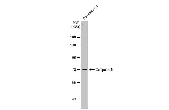 Western Blot Calpain 5 Antibody