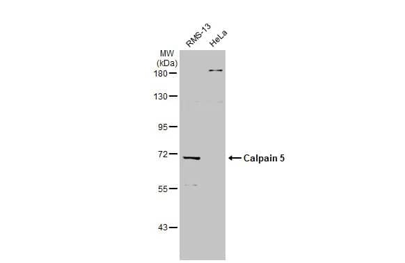 Western Blot Calpain 5 Antibody