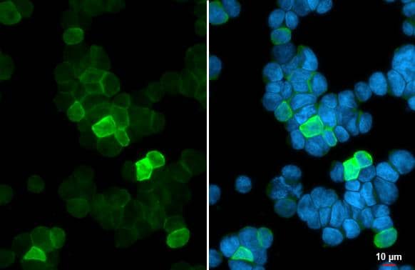 GNAL antibody detects GNAL protein at cell membrane by immunofluorescent analysis.Sample: Jurkat cells were fixed in 4% paraformaldehyde at RT for 15 min.Green: GNAL stained by GNAL antibody (NBP1-32225) diluted at 1:500.Blue: Fluoroshield with DAPI . 