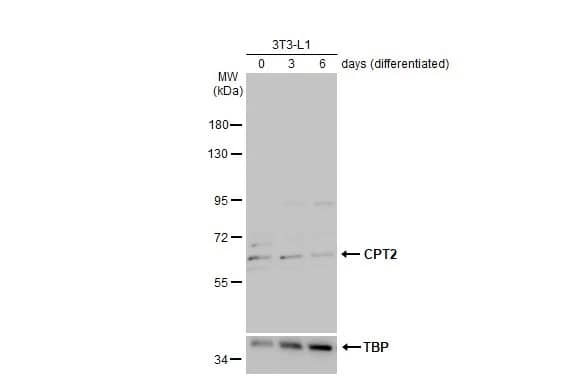 Western Blot: CPT2 Antibody [NBP1-32226] - Various whole cell extracts (30 ug) were separated by 7.5% SDS-PAGE, and the membrane was blotted with CPT2 antibody [N1C1] (NBP1-32226) diluted at 1:1000. The HRP-conjugated anti-rabbit IgG antibody  was used to detect the primary antibody.