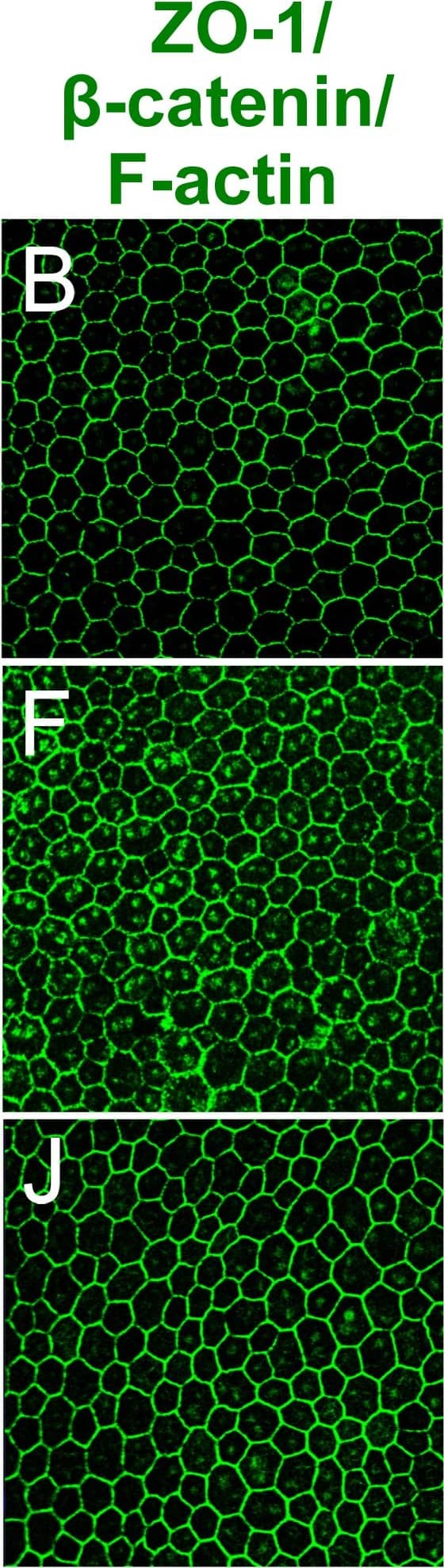 Immunocytochemistry/ Immunofluorescence: beta-Catenin Antibody [NBP1-32239] - P-cadherin is co-localized with other junctional proteins at the RPE cell border in mice.Immunofluorescence of mouse RPE flat-mounts. Double staining: P-cadherin (red; A, E, I) & either ZO-1 (green; B),  beta -catenin (green; F), or F-actin (green; J), with nuclear stain by DAPI (blue; C, G, K). Merged images (D, H, L) show the co-localization of P-cadherin with ZO-1 (tight junction),  beta -catenin (adherens junction), & F-actin (adherens junction) at the cell-cell border. Image collected & cropped by CiteAb from the following publication (//pubmed.ncbi.nlm.nih.gov/29338041), licensed under a CC-BY license. Not internally tested by Novus Biologicals.