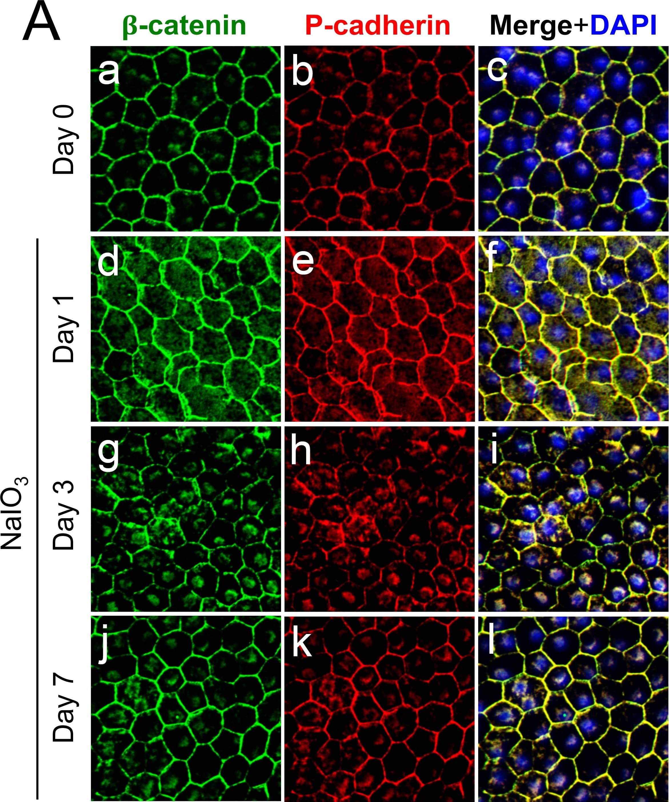 Immunocytochemistry/ Immunofluorescence: beta-Catenin Antibody [NBP1-32239] - Oxidative stress-induced dissociation of adherens junctions results in nuclear translocation of  beta -catenin & an increase of EMT-related factors in mouse RPE.(A) Immunofluorescence of mouse RPE flat-mounts. Mice were injected with NaIO3 (15 mg/kg body weight) on Day 0, & the localization of  beta -catenin (green) & P-cadherin (red) was analyzed along with nuclear stain by DAPI (blue) on Days 0 (a-c), 1 (d-f), 3 (g-i) & 7 (j-l). Double staining:  beta -catenin (a, d, g, j), P-cadherin (b, e, h, k), & merged images with DAPI (c, f, i, l). The localization of  beta -catenin & P-cadherin at the cell-cell border was significantly disrupted, & instead prominently detected on/in the nucleus on Day 3. (B) Immunofluorescence of mouse retinal sections with a focus on the RPE nuclei. Mice were injected with NaIO3 (15 mg/kg body weight) on Day 0, & the localization of  beta -catenin (green) & P-cadherin (red) was analyzed along with nuclear stain by DAPI (blue) on Days 0 (m-o) & 3 (two representative nuclei; p-r & s-u). Double staining:  beta -catenin (m, p, s), P-cadherin (n, q, t), & merged images with DAPI (o, r, u). On Day 3,  beta -catenin was detected in the nuclei of mouse RPE. (C) Western blot analyses of mouse RPE proteins. Mice were injected with NaIO3 (15 mg/kg body weight) on Day 0, & RPE protein lysates were prepared on Days 0, 1, 3, & 7. The protein levels were analyzed using Western blotting with antibodies against P-cadherin,  beta -catenin, SNAI1 (Snail), vimentin, & control  beta -actin. The protein levels of  beta -catenin & SNAI1 increased similarly on Day 1 following oxidative stress. Image collected & cropped by CiteAb from the following publication (//pubmed.ncbi.nlm.nih.gov/29338041), licensed under a CC-BY license. Not internally tested by Novus Biologicals.