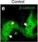 Immunocytochemistry/ Immunofluorescence: beta-Catenin Antibody [NBP1-32239] - WNT10A/ beta -catenin signalling is required for region-specific differentiation.(a–d) Filiform papillae are present in Wnt10a−/− & inducible  beta -catenin mutant dorsal tongue (yellow arrows), but horny structures & expression of hard keratins (in situ hybridization, purple signals) are decreased (red arrows). (e–l) Epithelial deletion of Wnt10a (e–f″,i,j) or  beta -catenin (g–h″,k,l) induced from P25, P110 or P15 as indicated causes decreased expression of nuclear  beta -catenin, LEF1 & HOXC13 (white arrows, LEF1+ proliferating cells; yellow arrows, HOXC13+ differentiating cells). (m) qPCR shows significantly decreased Hoxc13 levels in Wnt10a &  beta -catenin mutant tongue epithelium. (n–r) IF & qPCR reveal reduced levels of KRT9 protein (n–q) & mRNA (r) in Wnt10a−/− & inducible  beta -catenin mutant footpad epidermis. (s–v″) Co-IF for KRT9 & KRT10 in plantar epidermis from patients homozygous for WNT10A c.756+1G>A (s–t″) or WNT10A c.391G>A (u–v″) compared with similarly aged sex-matched controls. For qPCR, RNA levels were quantified in six control & six mutant (P40) or four control & four mutant (P20-100) samples with three technical replicates for each, & normalized to  beta -actin mRNA. Significance was calculated with two-tailed Student's t-test. Error bars indicate s.e.m. Scale bar, 25 μm (e–l) or 50 μm (a–d,n–q,s–v″). Image collected & cropped by CiteAb from the following publication (//www.nature.com/articles/ncomms15397), licensed under a CC-BY license. Not internally tested by Novus Biologicals.