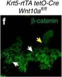 Immunocytochemistry/ Immunofluorescence: beta-Catenin Antibody [NBP1-32239] - WNT10A/ beta -catenin signalling is required for region-specific differentiation.(a–d) Filiform papillae are present in Wnt10a−/− & inducible  beta -catenin mutant dorsal tongue (yellow arrows), but horny structures & expression of hard keratins (in situ hybridization, purple signals) are decreased (red arrows). (e–l) Epithelial deletion of Wnt10a (e–f″,i,j) or  beta -catenin (g–h″,k,l) induced from P25, P110 or P15 as indicated causes decreased expression of nuclear  beta -catenin, LEF1 & HOXC13 (white arrows, LEF1+ proliferating cells; yellow arrows, HOXC13+ differentiating cells). (m) qPCR shows significantly decreased Hoxc13 levels in Wnt10a &  beta -catenin mutant tongue epithelium. (n–r) IF & qPCR reveal reduced levels of KRT9 protein (n–q) & mRNA (r) in Wnt10a−/− & inducible  beta -catenin mutant footpad epidermis. (s–v″) Co-IF for KRT9 & KRT10 in plantar epidermis from patients homozygous for WNT10A c.756+1G>A (s–t″) or WNT10A c.391G>A (u–v″) compared with similarly aged sex-matched controls. For qPCR, RNA levels were quantified in six control & six mutant (P40) or four control & four mutant (P20-100) samples with three technical replicates for each, & normalized to  beta -actin mRNA. Significance was calculated with two-tailed Student's t-test. Error bars indicate s.e.m. Scale bar, 25 μm (e–l) or 50 μm (a–d,n–q,s–v″). Image collected & cropped by CiteAb from the following publication (//www.nature.com/articles/ncomms15397), licensed under a CC-BY license. Not internally tested by Novus Biologicals.