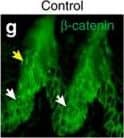 Immunocytochemistry/ Immunofluorescence: beta-Catenin Antibody [NBP1-32239] - WNT10A/ beta -catenin signalling is required for region-specific differentiation.(a–d) Filiform papillae are present in Wnt10a−/− & inducible  beta -catenin mutant dorsal tongue (yellow arrows), but horny structures & expression of hard keratins (in situ hybridization, purple signals) are decreased (red arrows). (e–l) Epithelial deletion of Wnt10a (e–f″,i,j) or  beta -catenin (g–h″,k,l) induced from P25, P110 or P15 as indicated causes decreased expression of nuclear  beta -catenin, LEF1 & HOXC13 (white arrows, LEF1+ proliferating cells; yellow arrows, HOXC13+ differentiating cells). (m) qPCR shows significantly decreased Hoxc13 levels in Wnt10a &  beta -catenin mutant tongue epithelium. (n–r) IF & qPCR reveal reduced levels of KRT9 protein (n–q) & mRNA (r) in Wnt10a−/− & inducible  beta -catenin mutant footpad epidermis. (s–v″) Co-IF for KRT9 & KRT10 in plantar epidermis from patients homozygous for WNT10A c.756+1G>A (s–t″) or WNT10A c.391G>A (u–v″) compared with similarly aged sex-matched controls. For qPCR, RNA levels were quantified in six control & six mutant (P40) or four control & four mutant (P20-100) samples with three technical replicates for each, & normalized to  beta -actin mRNA. Significance was calculated with two-tailed Student's t-test. Error bars indicate s.e.m. Scale bar, 25 μm (e–l) or 50 μm (a–d,n–q,s–v″). Image collected & cropped by CiteAb from the following publication (//www.nature.com/articles/ncomms15397), licensed under a CC-BY license. Not internally tested by Novus Biologicals.