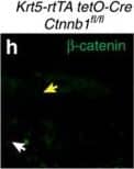 Immunocytochemistry/ Immunofluorescence: beta-Catenin Antibody [NBP1-32239] - WNT10A/ beta -catenin signalling is required for region-specific differentiation.(a–d) Filiform papillae are present in Wnt10a−/− & inducible  beta -catenin mutant dorsal tongue (yellow arrows), but horny structures & expression of hard keratins (in situ hybridization, purple signals) are decreased (red arrows). (e–l) Epithelial deletion of Wnt10a (e–f″,i,j) or  beta -catenin (g–h″,k,l) induced from P25, P110 or P15 as indicated causes decreased expression of nuclear  beta -catenin, LEF1 & HOXC13 (white arrows, LEF1+ proliferating cells; yellow arrows, HOXC13+ differentiating cells). (m) qPCR shows significantly decreased Hoxc13 levels in Wnt10a &  beta -catenin mutant tongue epithelium. (n–r) IF & qPCR reveal reduced levels of KRT9 protein (n–q) & mRNA (r) in Wnt10a−/− & inducible  beta -catenin mutant footpad epidermis. (s–v″) Co-IF for KRT9 & KRT10 in plantar epidermis from patients homozygous for WNT10A c.756+1G>A (s–t″) or WNT10A c.391G>A (u–v″) compared with similarly aged sex-matched controls. For qPCR, RNA levels were quantified in six control & six mutant (P40) or four control & four mutant (P20-100) samples with three technical replicates for each, & normalized to  beta -actin mRNA. Significance was calculated with two-tailed Student's t-test. Error bars indicate s.e.m. Scale bar, 25 μm (e–l) or 50 μm (a–d,n–q,s–v″). Image collected & cropped by CiteAb from the following publication (//www.nature.com/articles/ncomms15397), licensed under a CC-BY license. Not internally tested by Novus Biologicals.