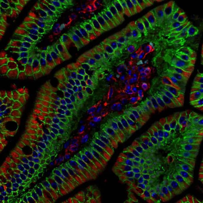 Immunohistochemistry-Paraffin: beta-Catenin Antibody [NBP1-32239] - beta-Catenin antibody [N1N2-2] detects beta-Catenin protein at cell membrane in mouse colon by immunohistochemical analysis. Sample: Paraffin-embedded mouse colon. Green: beta-Catenin antibody [N1N2-2] (NBP1-32239) diluted at 1:500.Red: alpha Tubulin antibody [GT114]  diluted at 1:500. Blue: Hoechst 33342 staining.Antigen Retrieval: Citrate buffer, pH 6.0, 15 min