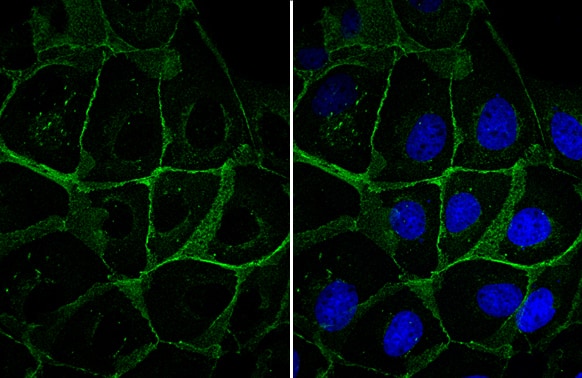 Immunocytochemistry/ Immunofluorescence: beta-Catenin Antibody [NBP1-32239] - beta-Catenin antibody detects beta-Catenin protein at cell membrane by immunofluorescent analysis.Sample: MDCK cells were fixed in 4% paraformaldehyde at RT for 15 min.Green: beta-Catenin stained by beta-Catenin antibody (NBP1-32239) diluted at 1:1000.