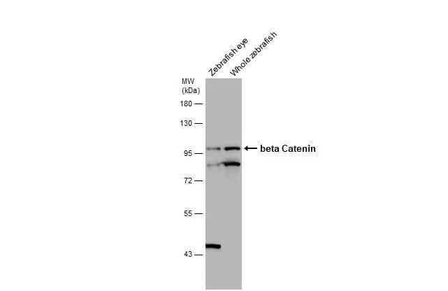 Western Blot: beta-Catenin Antibody [NBP1-32239] - Various tissue extracts (30 ug) were separated by 7.5% SDS-PAGE, and the membrane was blotted with beta-Catenin antibody (NBP1-32239) diluted at 1:500. The HRP-conjugated anti-rabbit IgG antibody  was used to detect the primary antibody.