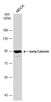 Western Blot: beta-Catenin Antibody [NBP1-32239] - Whole cell extract (30 ug) was separated by 7.5% SDS-PAGE, and the membrane was blotted with beta-Catenin antibody (NBP1-32239) diluted at 1:1000. The HRP-conjugated anti-rabbit IgG antibody  was used to detect the primary antibody, and the signal was developed with Trident ECL plus-Enhanced.