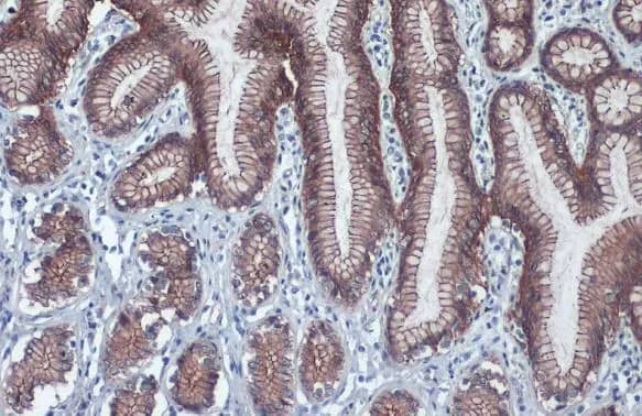 Immunohistochemistry-Paraffin: beta-Catenin Antibody [NBP1-32239] - beta-Catenin antibody detects beta-Catenin protein at cell membrane by immunohistochemical analysis.Sample: Paraffin-embedded cat colon.beta-Catenin stained by beta-Catenin antibody (NBP1-32239) diluted at 1:500.Antigen Retrieval: Citrate buffer, pH 6.0, 15 min