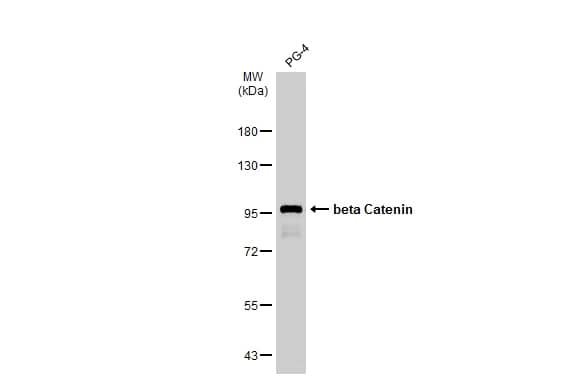 Western Blot: beta-Catenin Antibody [NBP1-32239] - Whole cell extract (30 ug) was separated by 7.5% SDS-PAGE, and the membrane was blotted with beta-Catenin antibody (NBP1-32239) diluted at 1:1000. The HRP-conjugated anti-rabbit IgG antibody  was used to detect the primary antibody.