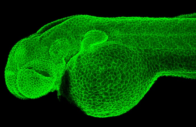 Immunohistochemistry: beta-Catenin Antibody [NBP1-32239] - beta-Catenin antibody [N1N2-2], N-term detects Ctnnb1 protein on zebrafish by whole mount immunohistochemical analysis. Sample: 2 days-post-fertilization zebrafish embryo. beta-Catenin antibody [N1N2-2], N-term (NBP1-32239) dilution: 1:100.