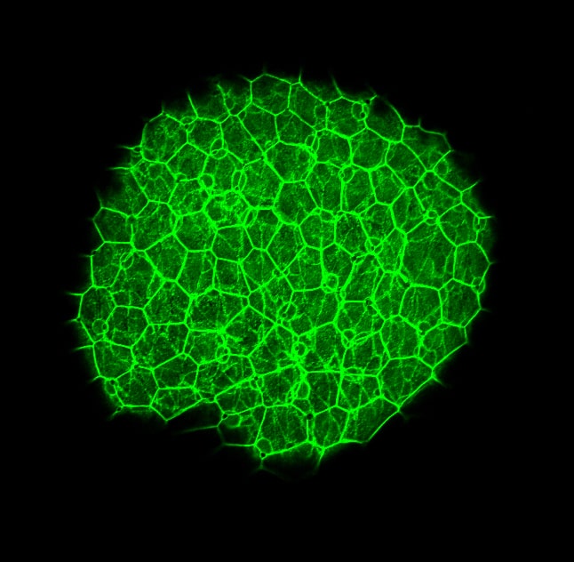 Immunohistochemistry: beta-Catenin Antibody [NBP1-32239] - beta-Catenin antibody [N1N2-2], N-term detects Ctnnb1 protein on zebrafish by whole mount immunohistochemical analysis. Sample: 2 days-post-fertilization zebrafish embryo. beta-Catenin antibody [N1N2-2], N-term (NBP1-32239) dilution: 1:100.