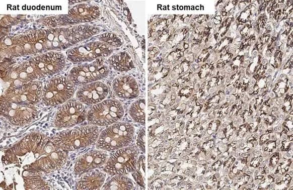 Immunohistochemistry-Paraffin: beta-Catenin Antibody [NBP1-32239] - beta-Catenin antibody [N1N2-2], N-term detects beta-Catenin protein by immunohistochemical analysis.Sample: Paraffin-embedded rat tissues.beta-Catenin stained by beta-Catenin antibody [N1N2-2], N-term (NBP1-32239) diluted at 1:500.Antigen Retrieval: Citrate buffer, pH 6.0, 15 min