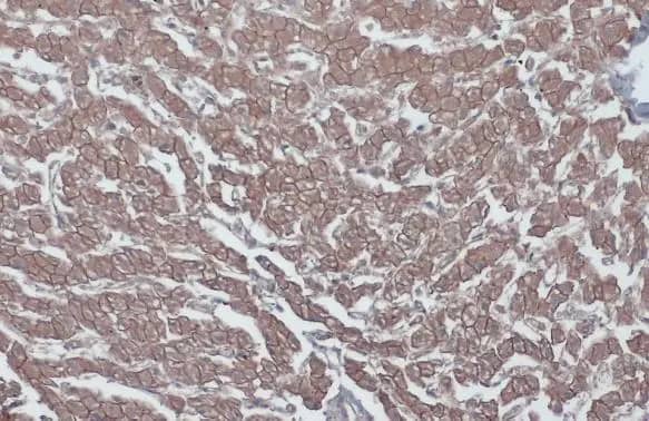 Immunohistochemistry-Paraffin: beta-Catenin Antibody [NBP1-32239] - beta-Catenin antibody detects beta-Catenin protein at cell membrane by immunohistochemical analysis.Sample: Paraffin-embedded cat liver.beta-Catenin stained by beta-Catenin antibody (NBP1-32239) diluted at 1:500.Antigen Retrieval: Citrate buffer, pH 6.0, 15 min