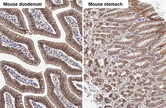 Immunohistochemistry-Paraffin: beta-Catenin Antibody [NBP1-32239] - beta-Catenin antibody [N1N2-2], N-term detects beta-Catenin protein by immunohistochemical analysis.Sample: Paraffin-embedded mouse tissues.beta-Catenin stained by beta-Catenin antibody [N1N2-2], N-term (NBP1-32239) diluted at 1:500.Antigen Retrieval: Citrate buffer, pH 6.0, 15 min