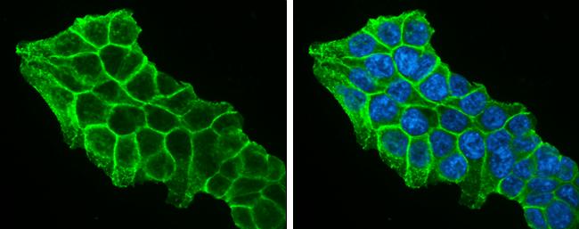beta-Catenin antibody [N1N2-2], N-term detects beta-Catenin protein at cell membrane by immunofluorescent analysis.Sample: HCT 116 cells were fixed in 4% paraformaldehyde at RT for 15 min.Green: beta-Catenin protein stained by beta-Catenin antibody [N1N2-2], N-term (NBP1-32239) diluted at 1:500.Blue: Hoechst 33342 staining. 