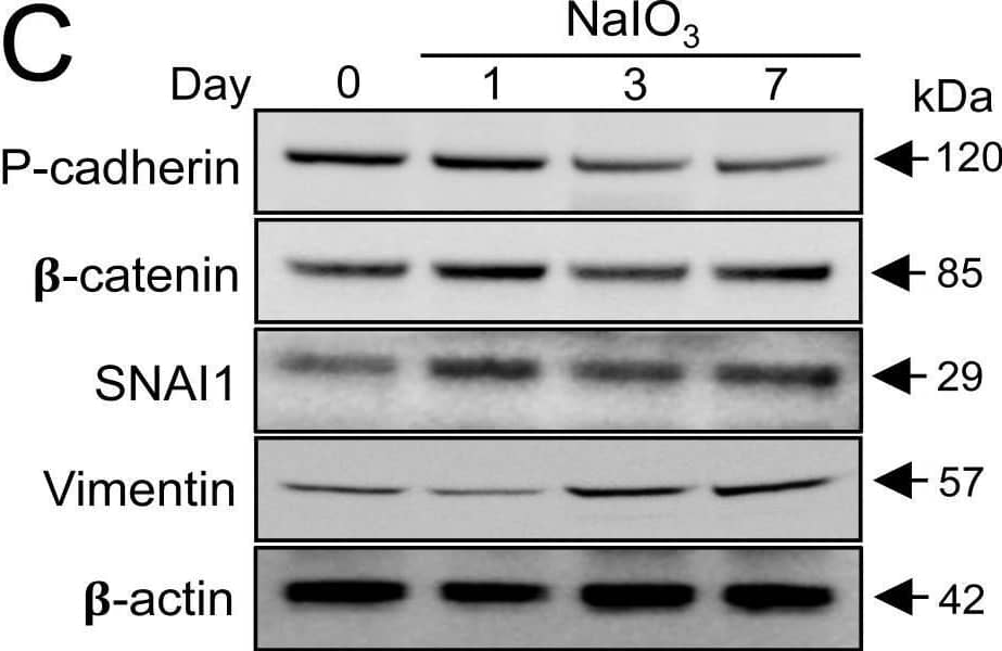 Oxidative stress-induced dissociation of adherens junctions results in nuclear translocation of  beta -catenin and an increase of EMT-related factors in mouse RPE.(A) Immunofluorescence of mouse RPE flat-mounts. Mice were injected with NaIO3 (15 mg/kg body weight) on Day 0, and the localization of  beta -catenin (green) and P-cadherin (red) was analyzed along with nuclear stain by DAPI (blue) on Days 0 (a-c), 1 (d-f), 3 (g-i) and 7 (j-l). Double staining:  beta -catenin (a, d, g, j), P-cadherin (b, e, h, k), and merged images with DAPI (c, f, i, l). The localization of  beta -catenin and P-cadherin at the cell-cell border was significantly disrupted, and instead prominently detected on/in the nucleus on Day 3. (B) Immunofluorescence of mouse retinal sections with a focus on the RPE nuclei. Mice were injected with NaIO3 (15 mg/kg body weight) on Day 0, and the localization of  beta -catenin (green) and P-cadherin (red) was analyzed along with nuclear stain by DAPI (blue) on Days 0 (m-o) and 3 (two representative nuclei; p-r and s-u). Double staining:  beta -catenin (m, p, s), P-cadherin (n, q, t), and merged images with DAPI (o, r, u). On Day 3,  beta -catenin was detected in the nuclei of mouse RPE. (C) Western blot analyses of mouse RPE proteins. Mice were injected with NaIO3 (15 mg/kg body weight) on Day 0, and RPE protein lysates were prepared on Days 0, 1, 3, and 7. The protein levels were analyzed using Western blotting with antibodies against P-cadherin,  beta -catenin, SNAI1 (Snail), vimentin, and control  beta -actin. The protein levels of  beta -catenin and SNAI1 increased similarly on Day 1 following oxidative stress. Image collected and cropped by CiteAb from the following open publication (//pubmed.ncbi.nlm.nih.gov/29338041), licensed under a CC-BY license. Not internally tested by Novus Biologicals.