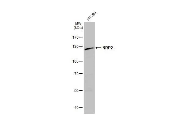 Western Blot: Neuropilin-2 Antibody [NBP1-32241] - Whole cell extract (30 ug) was separated by 7.5% SDS-PAGE, and the membrane was blotted with Neuropilin-2 antibody [N2N3] (NBP1-32241) diluted at 1:500. The HRP-conjugated anti-rabbit IgG antibody  was used to detect the primary antibody, and the signal was developed with Trident ECL plus-Enhanced.