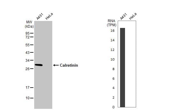 <b>Orthogonal Strategies Validation. </b>Western Blot: Calretinin Antibody [NBP1-32244] - Various whole cell extracts (30 ug) were separated by 12% SDS-PAGE, and the membrane was blotted with Calretinin antibody  diluted at 1:1000. The HRP-conjugated anti-rabbit IgG antibody  was used to detect the primary antibody. Corresponding RNA expression data for the same cell lines are based on Human Protein Atlas program.