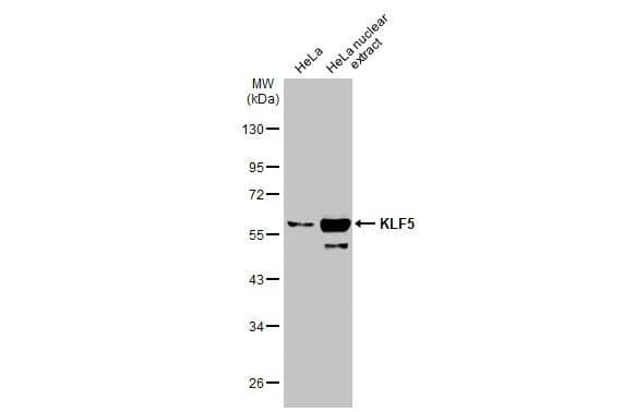 <b>Orthogonal Strategies Validation. </b>HeLa whole cell and nuclear extracts (30 ug) were separated by 10% SDS-PAGE, and the membrane was blotted with KLF5 antibody (NBP1-32245) diluted at 1:1000. The HRP-conjugated anti-rabbit IgG antibody was used to detect the primary antibody. 