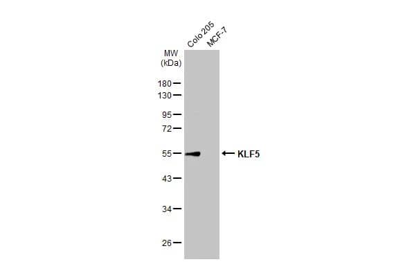 Various whole cell extracts (30 ug) were separated by 10% SDS-PAGE, and the membrane was blotted with KLF5 antibody (NBP1-32245) diluted at 1:1000. The HRP-conjugated anti-rabbit IgG antibody was used to detect the primary antibody. 