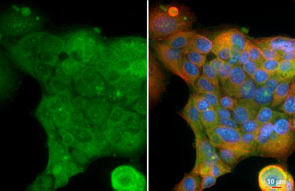 Glucosylceramidase/GBA antibody [C1C3] detects Glucosylceramidase/GBA protein by immunofluorescent analysis.Sample: MCF-7 cells were fixed in ice-cold MeOH for 5 min.Green: Glucosylceramidase/GBA stained by Glucosylceramidase/GBA antibody [C1C3] (NBP1-32271) diluted at 1:500.Red: alpha Tubulin, a cytoskeleton marker, stained by alpha Tubulin antibody [GT114] diluted at 1:1000.Blue: Fluoroshield with DAPI . 