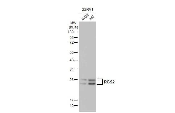 22RV1 whole cell and membrane extracts (30 ug) were separated by 12% SDS-PAGE, and the membrane was blotted with RGS2 antibody (NBP1-32284) diluted at 1:2500. The HRP-conjugated anti-rabbit IgG antibody 