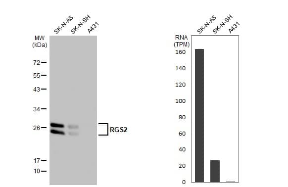 Various whole cell extracts (30 ug) were separated by 12% SDS-PAGE, and the membrane was blotted with RGS2 antibody (NBP1-32284) diluted at 1:1000. The HRP-conjugated anti-rabbit IgG antibody was used to detect the primary antibody. 