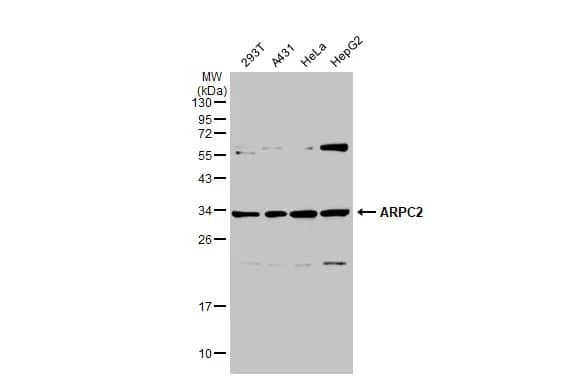 Western Blot: ARPC2 Antibody [NBP1-32297] - Various whole cell extracts (30 ug) were separated by 12% SDS-PAGE, and the membrane was blotted with ARPC2 antibody (NBP1-32297) diluted at 1:2000. The HRP-conjugated anti-rabbit IgG antibody  was used to detect the primary antibody.