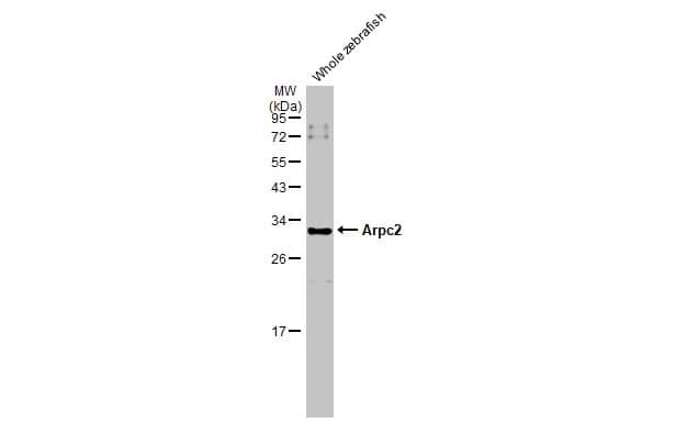 Western Blot: ARPC2 Antibody [NBP1-32297] - Whole cell extract (30 ug) was separated by 12% SDS-PAGE, and the membrane was blotted with ARPC2 antibody (NBP1-32297) diluted at 1:1000. The HRP-conjugated anti-rabbit IgG antibody  was used to detect the primary antibody.