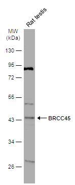 Rat tissue extract (50 ug) was separated by 10% SDS-PAGE, and the membrane was blotted with BRE antibody (NBP1-32304) diluted at 1:1000. The HRP-conjugated anti-rabbit IgG antibody was used to detect the primary antibody. 