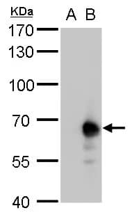 Western Blot: PKLR Antibody [NBP1-32314] - PKLR antibody detects PKLR protein by western blot analysis.A. 30 ug 293T whole cell lysate/extract B. 5 ug whole cell lysate/extract of human PKLR-transfected 293T cells7.5 % SDS-PAGEPKLR antibody (NBP1-32314) dilution: 1:10000