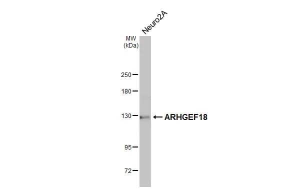 Whole cell extract (30 ug) was separated by 5% SDS-PAGE, and the membrane was blotted with ARHGEF18 antibody (NBP1-32816) diluted at 1:1000. The HRP-conjugated anti-rabbit IgG antibody  was used to detect the primary antibody. 
