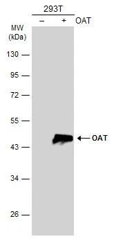 Western Blot: OAT Antibody [NBP1-32390] - Non-transfected (-) and transfected (+) 293T whole cell extracts (30 ug) were separated by 10% SDS-PAGE, and the membrane was blotted with OAT antibody [N1C3] (NBP1-32390) diluted at 1:5000. The HRP-conjugated anti-rabbit IgG antibody  was used to detect the primary antibody.