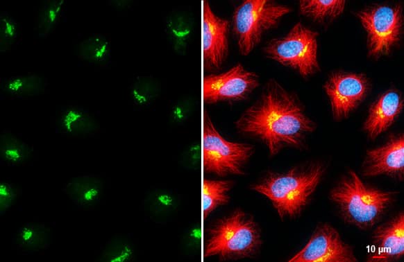 Immunocytochemistry/ Immunofluorescence: GALNT2 Antibody [NBP1-32394] - GALNT2 antibody detects GALNT2 protein at Golgi apparatus by immunofluorescent analysis.Sample: HeLa cells were fixed in ice-cold MeOH for 5 min.Green: GALNT2 stained by GALNT2 antibody (NBP1-32394) diluted at 1:500.Red: alpha Tubulin, stained by alpha Tubulin antibody [GT114]  diluted at 1:500.Blue: Fluoroshield with DAPI .Scale bar= 10 um.