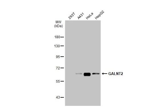 Western Blot: GALNT2 Antibody [NBP1-32394] - Various whole cell extracts (30 ug) were separated by 7.5% SDS-PAGE, and the membrane was blotted with GALNT2 antibody (NBP1-32394) diluted at 1:1000. The HRP-conjugated anti-rabbit IgG antibody  was used to detect the primary antibody.