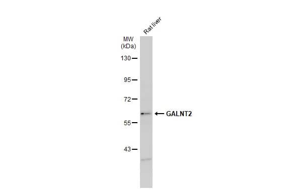 Western Blot: GALNT2 Antibody [NBP1-32394] - Rat tissue extract (50 ug) was separated by 7.5% SDS-PAGE, and the membrane was blotted with GALNT2 antibody (NBP1-32394) diluted at 1:500. The HRP-conjugated anti-rabbit IgG antibody  was used to detect the primary antibody.