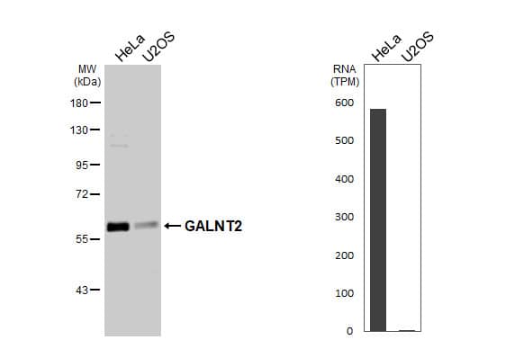 <b>Orthogonal Strategies Validation. </b>Various whole cell extracts (30 ug) were separated by 7.5% SDS-PAGE, and the membrane was blotted with GALNT2 antibody (NBP1-32394) diluted at 1:1000. The HRP-conjugated anti-rabbit IgG antibody was used to detect the primary antibody. Corresponding RNA expression data are based on Human Protein Atlas program. 