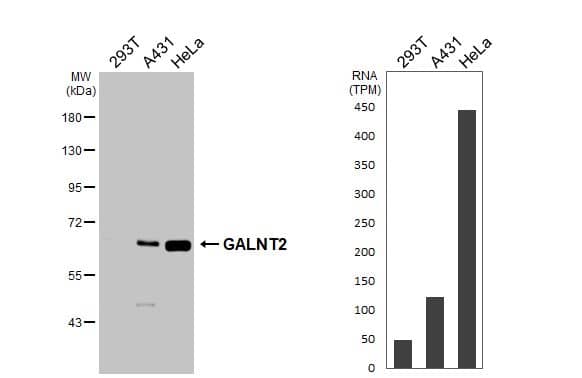 <b>Orthogonal Strategies Validation. </b>Various whole cell extracts (30 ug) were separated by 7.5% SDS-PAGE, and the membrane was blotted with GALNT2 antibody (NBP1-32394) diluted at 1:1000. The HRP-conjugated anti-rabbit IgG antibody was used to detect the primary antibody. Corresponding RNA expression data for the same cell lines are based on Human Protein Atlas program. 
