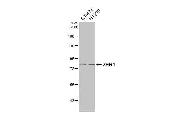 Various whole cell extracts (30 ug) were separated by 7.5% SDS-PAGE, and the membrane was blotted with ZER1 antibody [C2C3], C-term (NBP1-32801) diluted at 1:500. The HRP-conjugated anti-rabbit IgG antibody  was used to detect the primary antibody. 