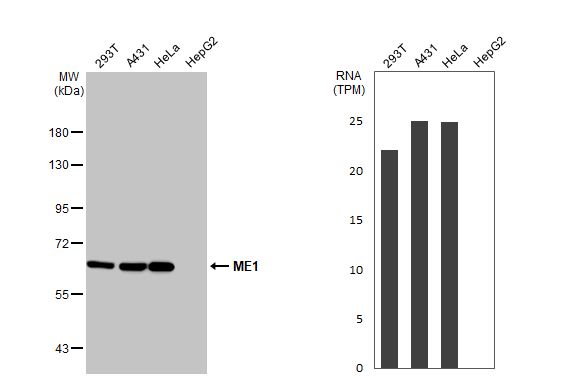 <b>Orthogonal Strategies Validation. </b>Various whole cell extracts (30 �g) were separated by 7.5% SDS-PAGE, and the membrane was blotted with ME1 antibody (NBP1-32398) diluted at 1:1000. The HRP-conjugated anti-rabbit IgG antibody was used to detect the primary antibody. Corresponding RNA expression data for the same cell lines are based on Human Protein Atlas program. 