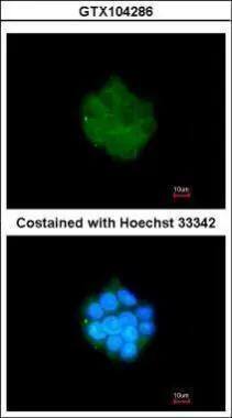 Immunofluorescence analysis of methanol-fixed HepG2, using PDK3(NBP1-32581) antibody at 1:200 dilution. 