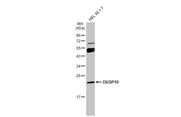 Western Blot: DUSP19 Antibody [NBP1-32399] - Whole cell extract (30 ug) was separated by 12% SDS-PAGE, and the membrane was blotted with DUSP19 antibody (NBP1-32399) diluted at 1:500. The HRP-conjugated anti-rabbit IgG antibody  was used to detect the primary antibody.