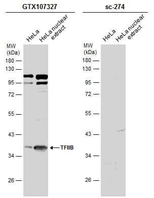 HeLa whole cell and nuclear extracts (30 ug) were separated by 10% SDS-PAGE, and the membranes were blotted with TFIIB antibody [N1C3] (NBP1-32622) diluted at 1:500 and competitor's antibody (sc-274) diluted at 1:500. The HRP-conjugated anti-rabbit IgG antibody  was used to detect the primary antibody.*The competitor is not affiliated with Novus and does not endorse this product. 